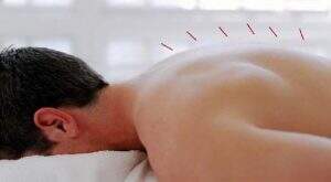 Curso de Dry Needing RJ