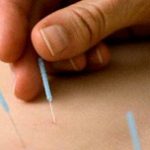 Clínica de Acupuntura Dr. Márcio de Luna RJ