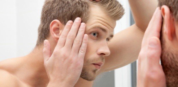 Baixa dosagem hormonal provoca calvície nos homens?