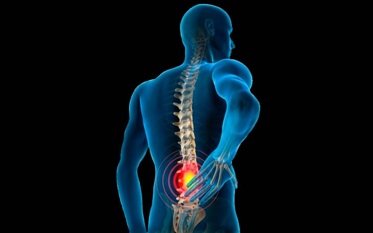 Unicid abre vagas para tratamento gratuito de dor lombar