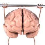Por que fazer ginástica para o cérebro?
