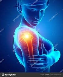 Já ouviu falar em ombro congelado?