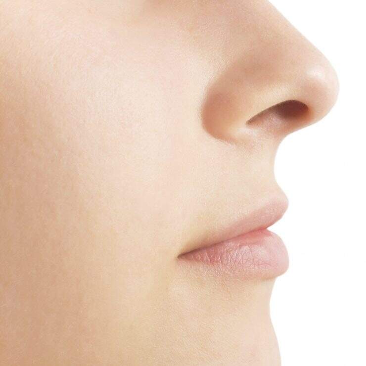 Técnica que corrige o nariz por dentro e por fora