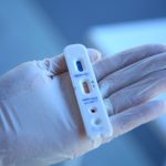 SEST SENAT vai realizar testes rápidos de covid-19 em 30 mil trabalhadores do transporte