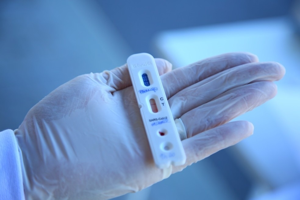 SEST SENAT vai realizar testes rápidos de covid-19 em 30 mil trabalhadores do transporte