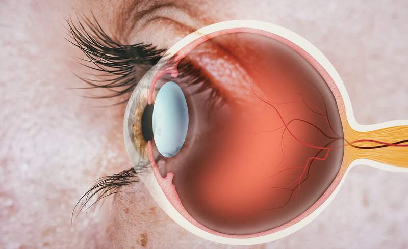 Estudo aponta que 20,2% das pessoas com diabetes no Brasil têm retinopatia, condição que pode levar à cegueira
