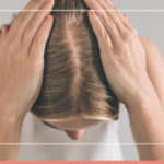 Entenda o que é a calvície feminina enfrentada pela Juliette e seus tratamentos