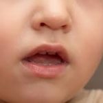 Você respira pela boca? Saiba identificar o problema