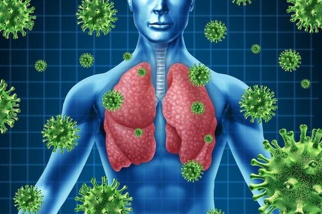 Avanço da gripe e indicadores da pneumonia alertam para a importância da vacinação